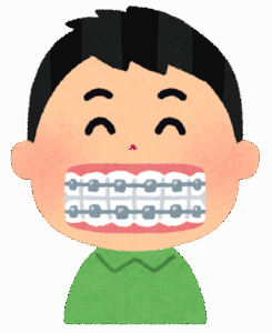 友達『えっ！お前歯の矯正始めたの！？』ワイ『うん。歯並び悪いのコンプレックスだったからさぁ～』