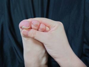 【痛風ワイ】 へへっ….きたぜ… ピリリとよ….🤠