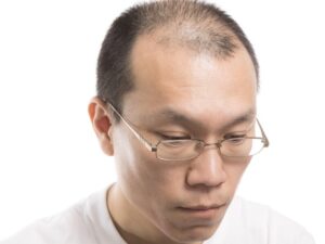 【画像】ハゲ隠しLv.999さん、見つかるwwwwwww