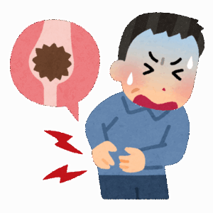 尿路結石と通風ってどっちが痛いの？