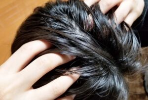 【朗報】ワイハゲ、神が作りし薬飲み始めてから抜け毛が劇的に減る