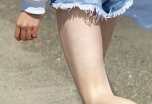 圧倒的『ムチムチBODY』だったチアさん、病的にガリった結果・・・