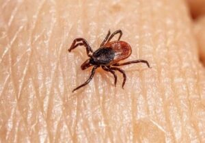 【画像】ワイ、『南京虫』か『ダニ』に噛まれて夏が終わる