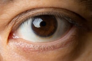 【画像】30年以上一重だった俺のまぶたに二重ラインが現れたぞｗｗｗｗｗｗｗｗｗ