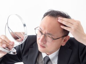 地上波で「ハゲ」禁止され、とんでもない名称に統一されてしまうｗｗｗｗｗ