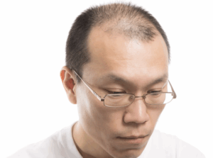 【画像】フィギュアヲタさん、やはりハゲだった