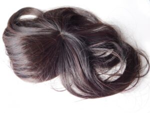 【閲覧注意】130万かけて植毛してきた