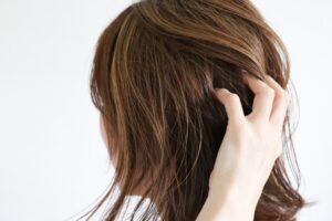 【閲覧注意】30歳でストレスマッハ喫煙者ワイの頭髪がコチラｗｗｗｗｗｗｗｗｗｗｗ