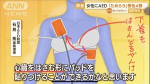 【朗報】AED財団「女性へのAED使用を躊躇う男性がいますが、使用法めっちゃ簡単ですw」←結果