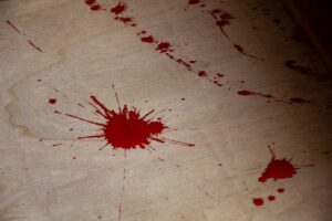 【画像あり】なんか亀頭に血豆出来てしまって怖い助けて